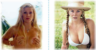 豊胸用錠、自然にバストアップ