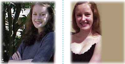 自然に豊胸,バストサイズのアップ